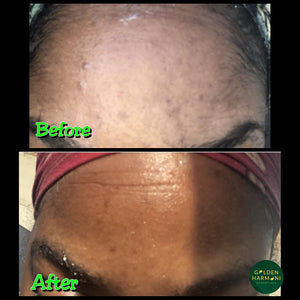 Golden Glow Facial System