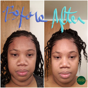 Golden Glow Facial System