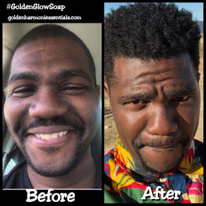Golden Glow Facial System